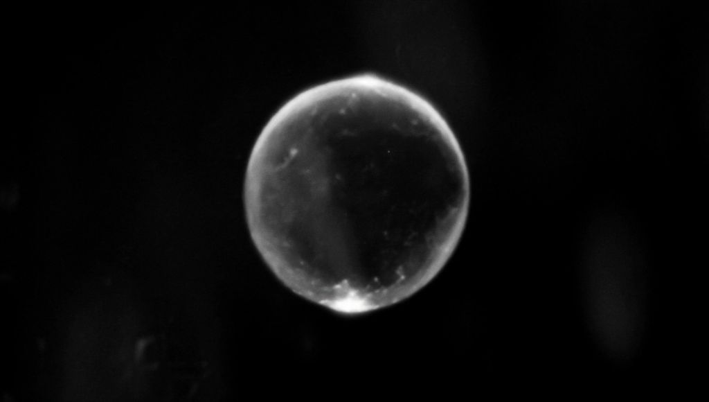 Stem cell sphere macro
